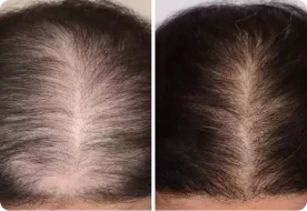 Louise's results